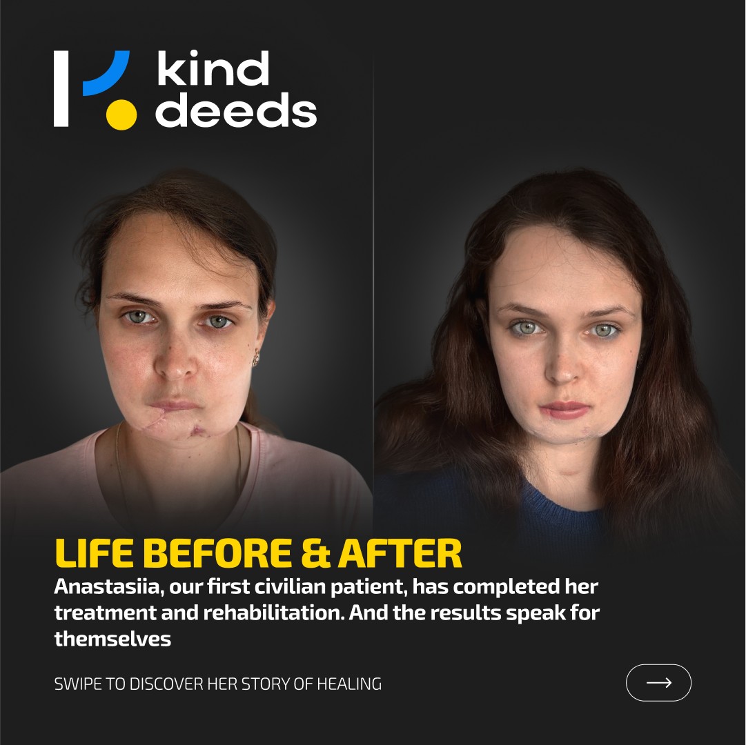 Kind Deeds’ First Civilian Patient Heads Home After a Year of Treatment and Healing